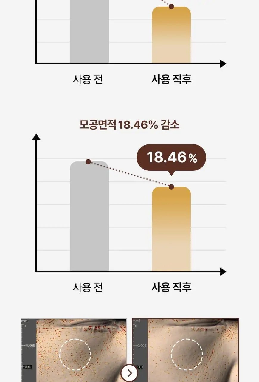 [화해어워드 1위/모공앰플] 닥터오라클 레티노타이트닝 비타민A 레티놀 앰플 50ml 상세페이지 22